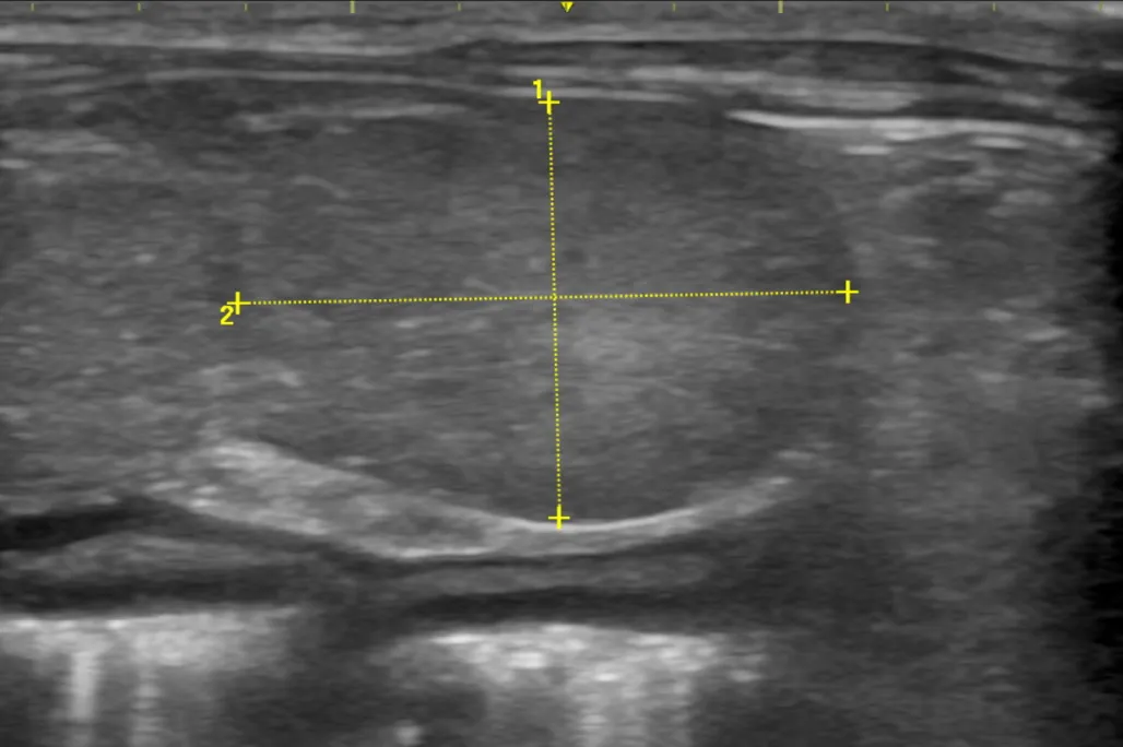 肝臓腫瘍を疑う高齢犬のサムネイル画像